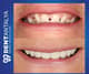 Slider image (9) Dent Antalya